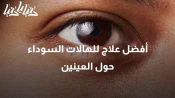 الهالات السوداء حول العينين: الأسباب والحلول الفعّالة للتخلص منها
