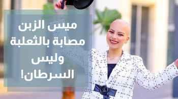الأردنية ميس الزبن تؤكد أن مرضها لم يكن السرطان كما انتشر اعلامياً