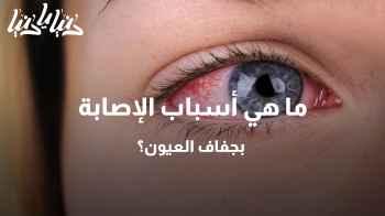 ما هي أسباب الإصابة بجفاف العيون؟